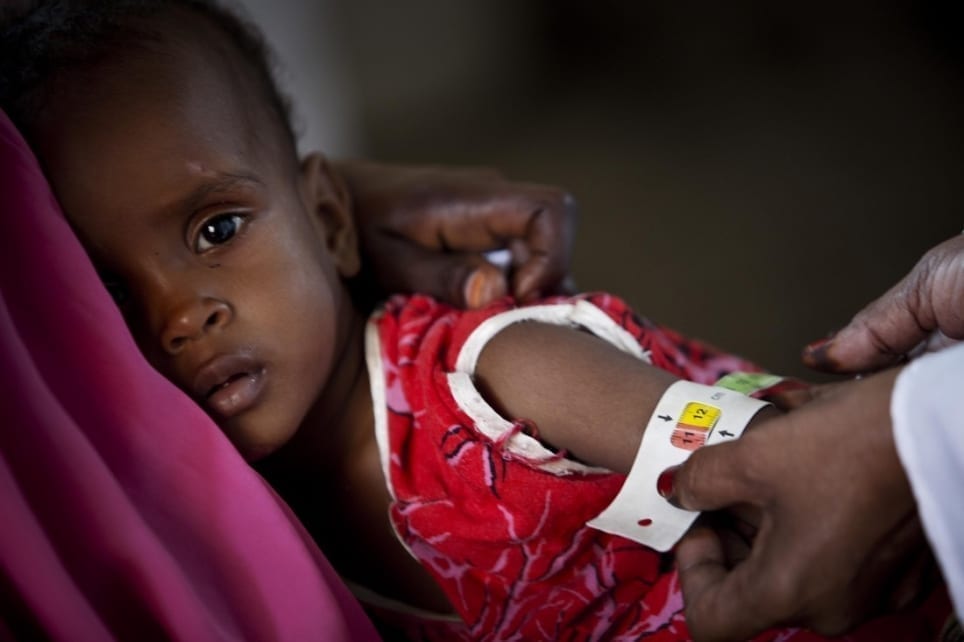 Why malnutrition is still a major problem in the world