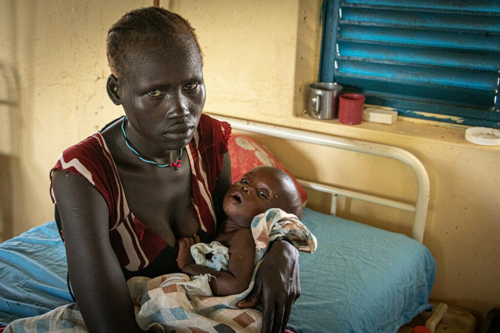 A mother holds her malnourished baby in a stabilisation centre.