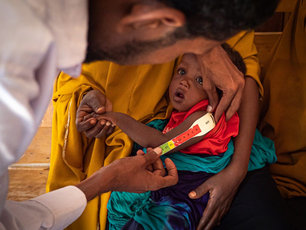 A young boy gets screened for malnutrition with the MUAC method (Mid upper arm circumference).
